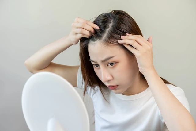Kunci Kesehatan Kulit Kepala untuk Rambut yang Sehat dan Berkilau