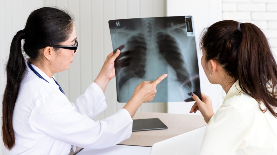 Biaya Rontgen Lengkap di Rumah Sakit, Klinik, dan Puskesmas