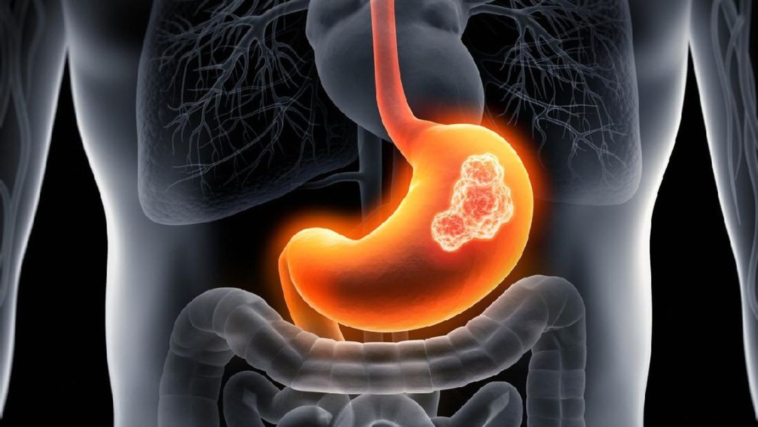 Pakar FKUI Ungkap Rahasia Medis Puasa Ramadan Bisa Menyehatkan Lambung Manusia