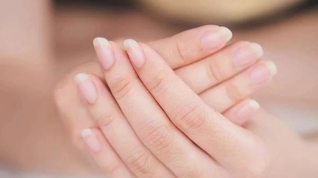Perubahan pada Kuku Bisa Menjadi Sinyal Penting untuk Menilai Kesehatan Tubuh