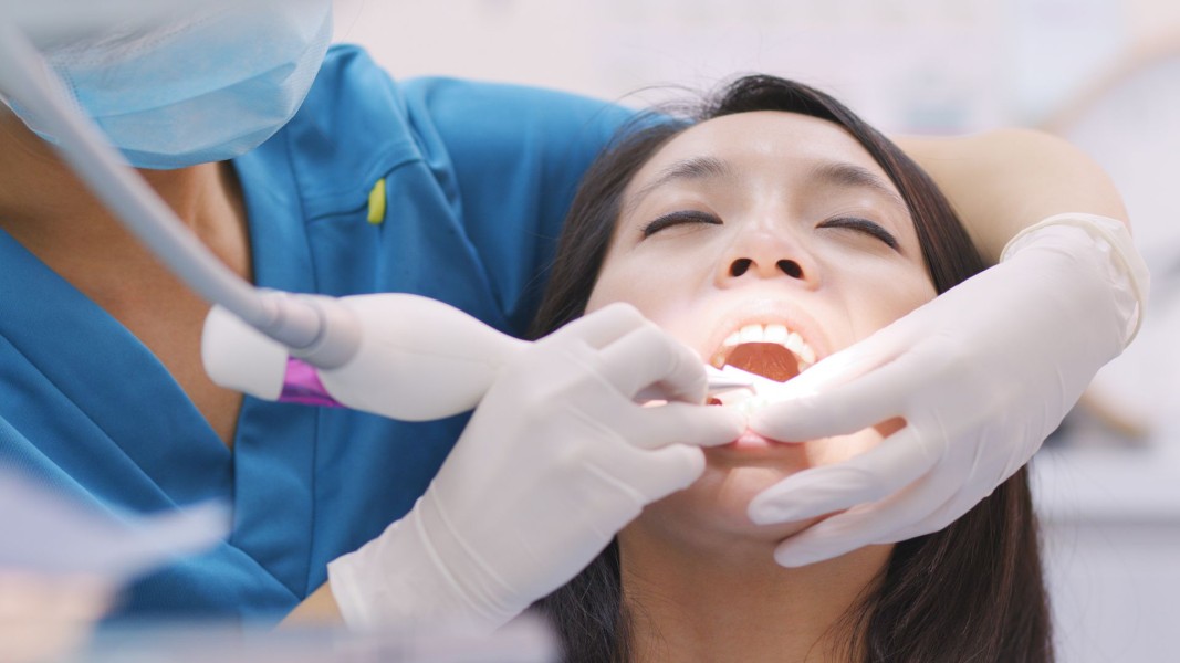 Scaling Gigi Gratis Pakai BPJS Kesehatan, Begini Syarat dan Prosedurnya