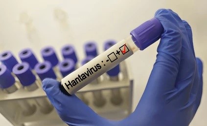 Kasus Virus Hanta di Indonesia Jadi Sorotan, Kemenkes Pastikan Pasien Telah Sembuh