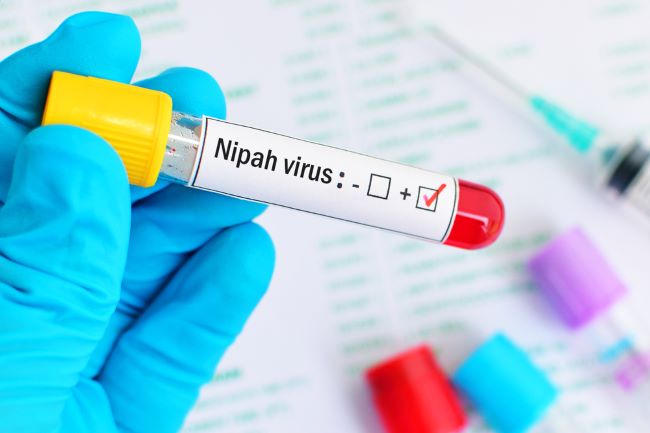 Indonesia Perlu Kesiagaan Lebih Baik Menghadapi Risiko Penyebaran Virus Nipah