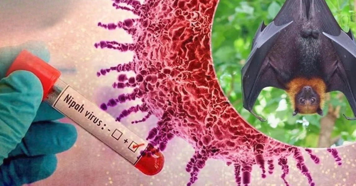 Waspada Ancaman Virus Nipah Pemerintah Perketat Pengawasan Pintu Masuk Indonesia