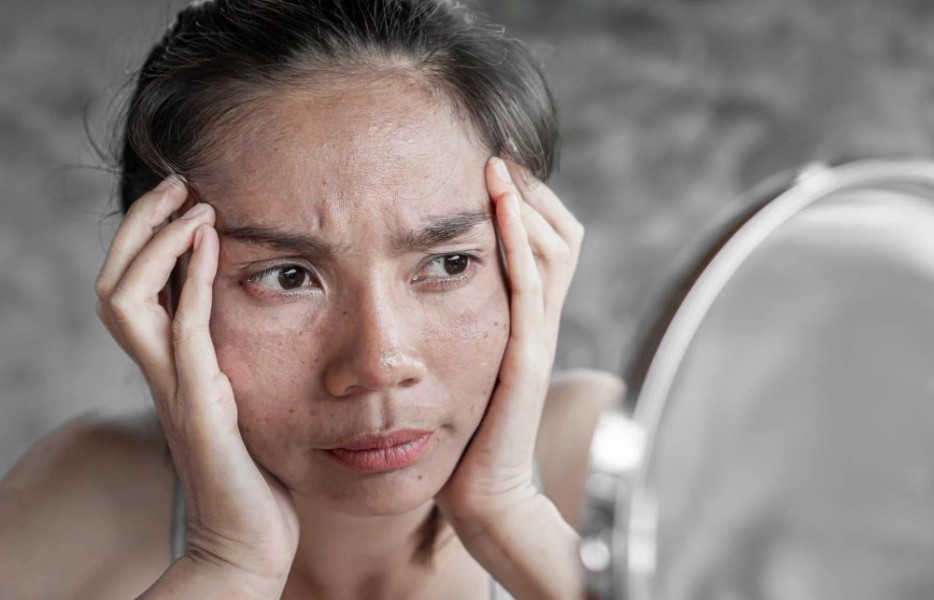 Wajah Kusam Meski Rutin Cuci Muka? Berikut Penyebab dan Cara Atasinya