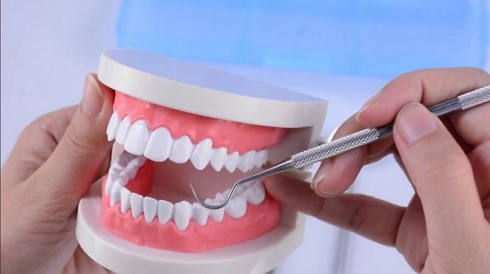 Daftar Biaya Operasi Gigi Bungsu di Rumah Sakit dan Klinik