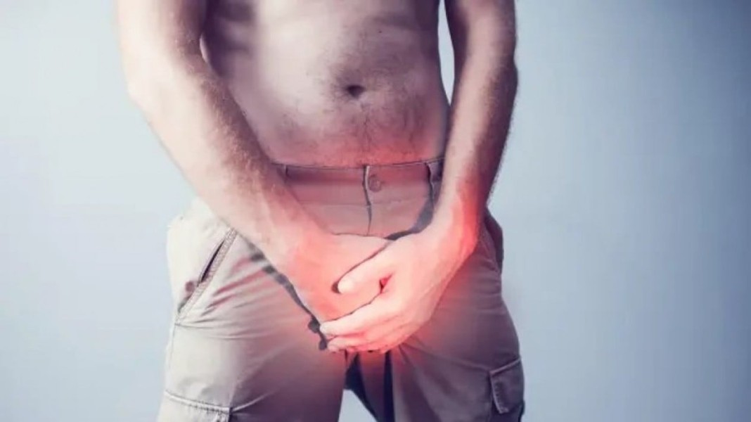 5 Cara Praktis Menjaga Kesehatan Organ Intim Pria