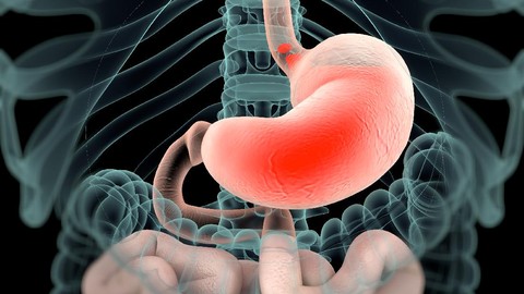 Perbedaan GERD Dan Maag Lengkap Penyebab Gejala Serta Letak Nyeri Pada Tubuh