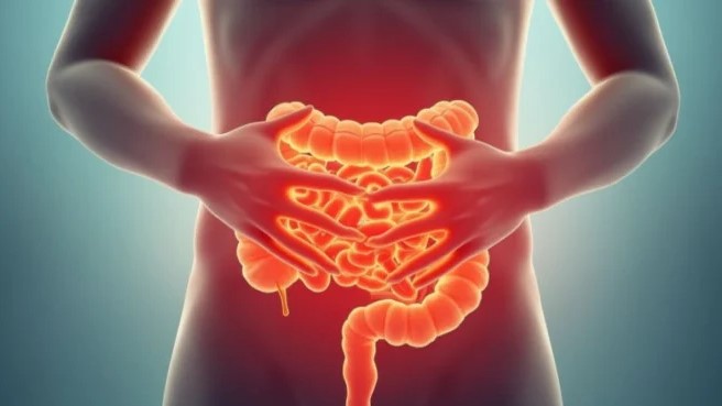5 Tanda Usus Bermasalah yang Sering Terabaikan dan Cara Mengatasinya