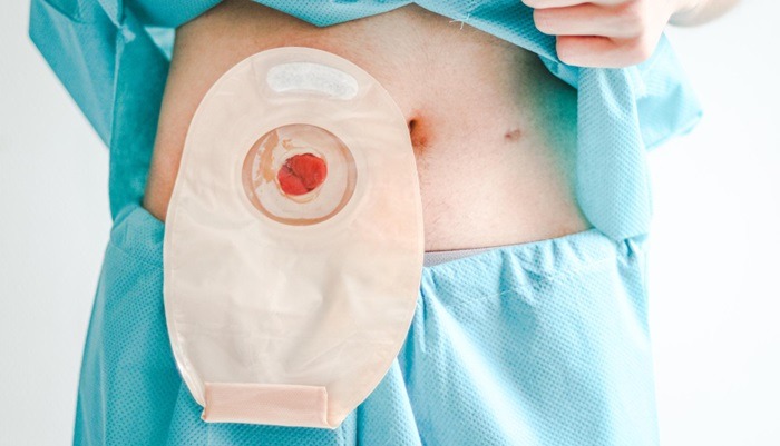 Daftar 6 Jenis Makanan Ampuh Cegah Kanker Usus Besar Bagi Generasi Z