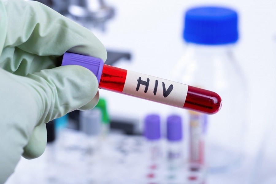 Dinas Kesehatan Kota Semarang Hadirkan Layanan Tes HIV dan ARV di Malam Hari, Ini Jadwal Lengkap Juni 2025