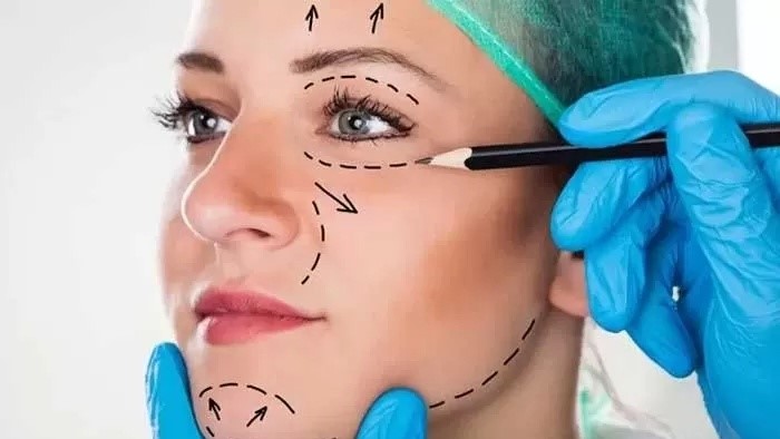 Operasi Plastik Tidak Pengaruhi Kesuburan, Diet Berlebihan Perlu Diwaspadai