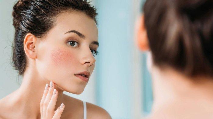 Tips Mengatasi Kulit Sensitif Agar Tetap Sehat Terjaga