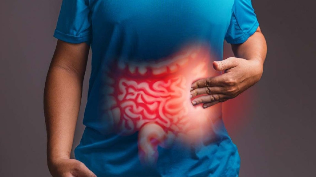 5 Kebiasaan Makan dan Minum Pemicu Kanker Usus Besar yang Harus Dihindari