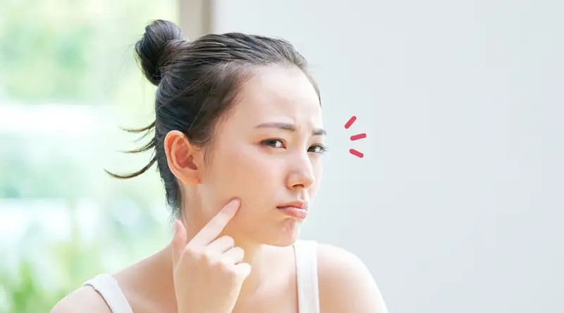 5 Jenis Benjolan Kecil di Wajah dan Penyebab Serta Cara Mengatasinya