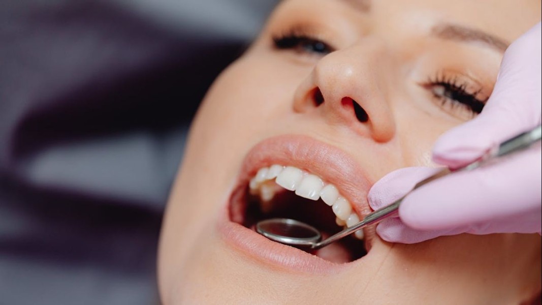 Menjaga Gigi dan Gusi Sehat Jadi Kunci Utama Mencegah Risiko Stroke Dini