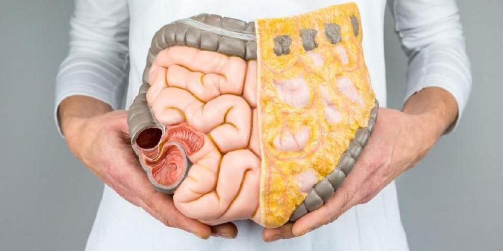 5 Gejala Tumor Usus Besar, Penyebab, hingga Pencegahannya