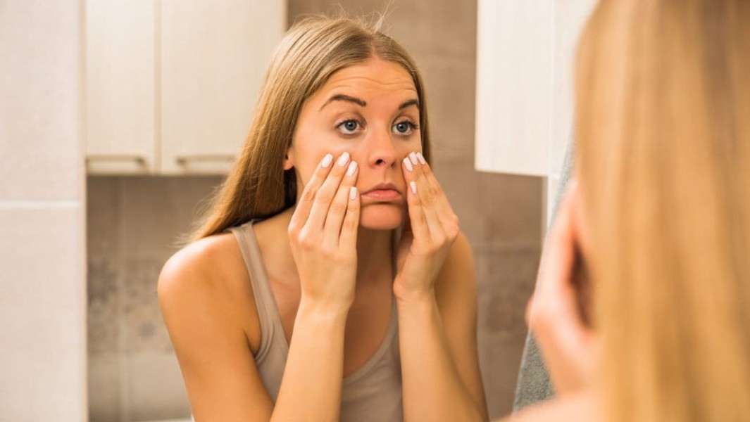 Mata Kering? Ini Tiga Cara Mengatasi Menurut Dokter Spesialis