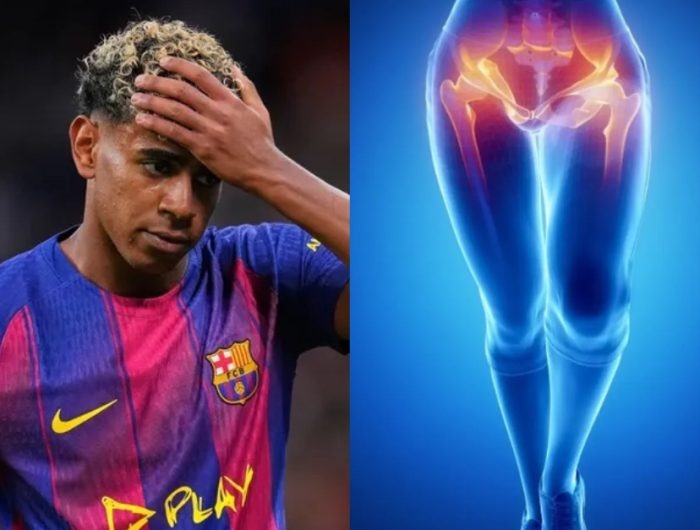 Barcelona Pastikan Kondisi Lamine Yamal Tetap Aman dan Terjaga