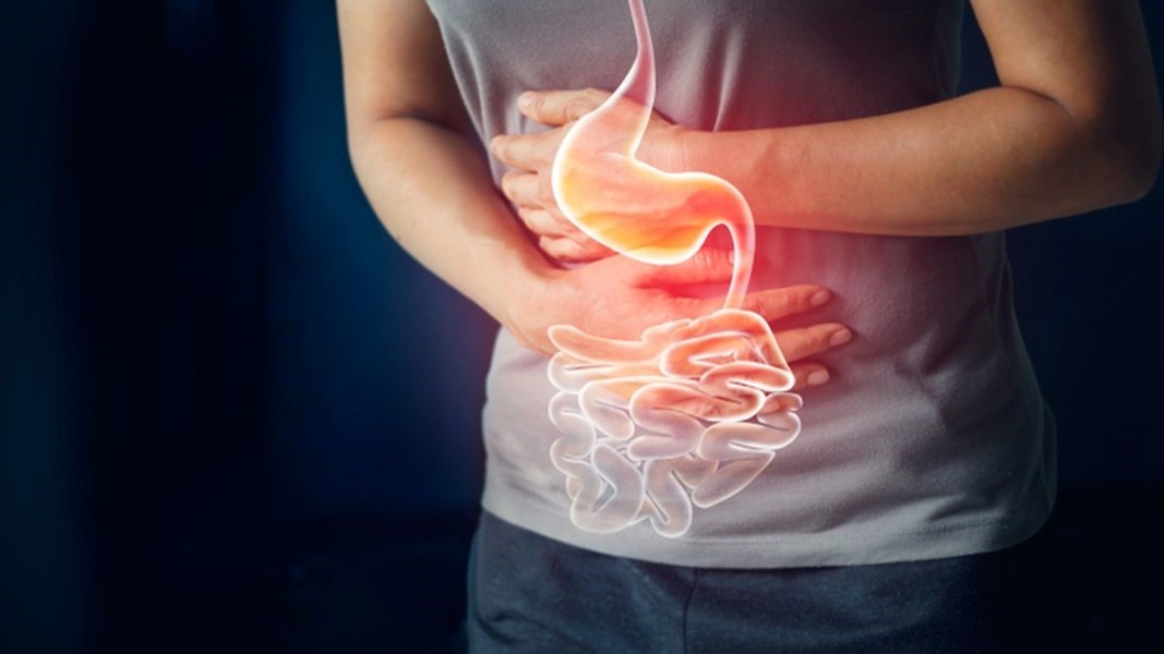 Dokter Jelaskan Perbedaan GERD dan Maag yang Perlu Diketahui
