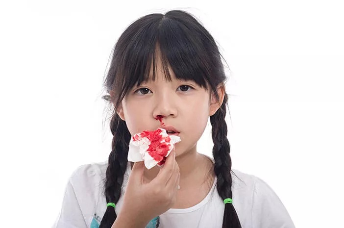 Cara Tenang Atasi Anak Mimisan Menurut Dokter
