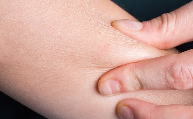 Cara Mudah Mengatasi Kulit Kering di Rumah Menggunakan Bahan Alami