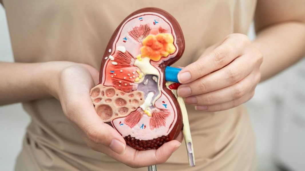 3 Kebiasaan Sehari-Hari yang Diam-Diam Menggerogoti Kesehatan Ginjal Anda