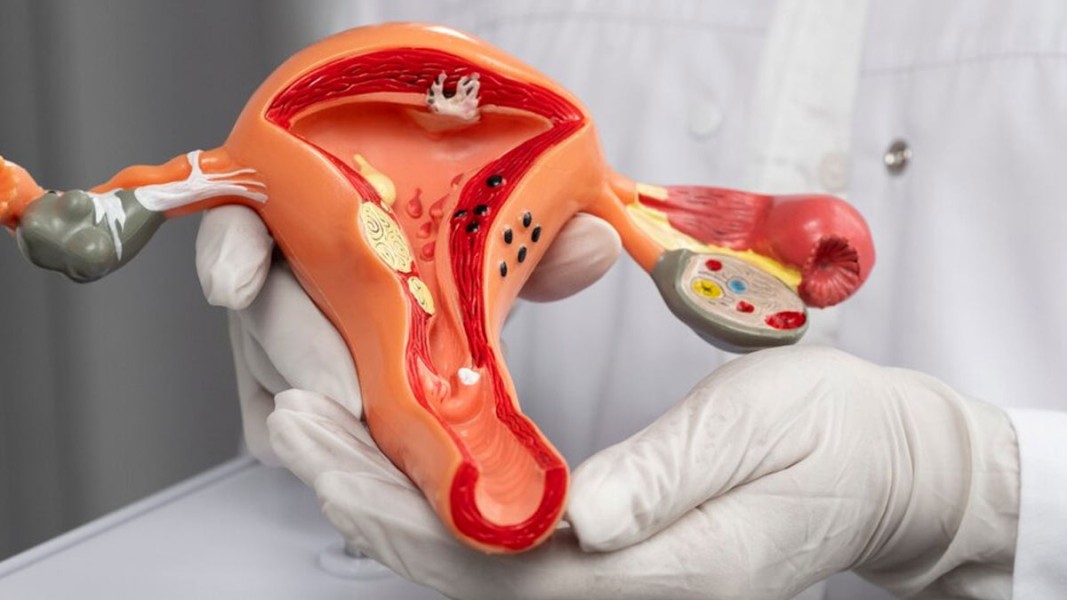 Berbagai Fungsi Endometrium dan Kelainan serta Penyebabnya