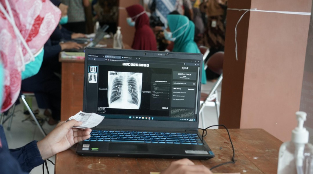 Kemenkes Dorong Aktif Masyarakat dalam Upaya Eliminasi TBC di Indonesia
