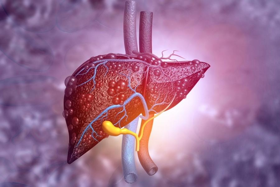 13 Cara Sederhana untuk Menjaga Kesehatan Liver, Cegah Masalah Hati dengan Kebiasaan Ini