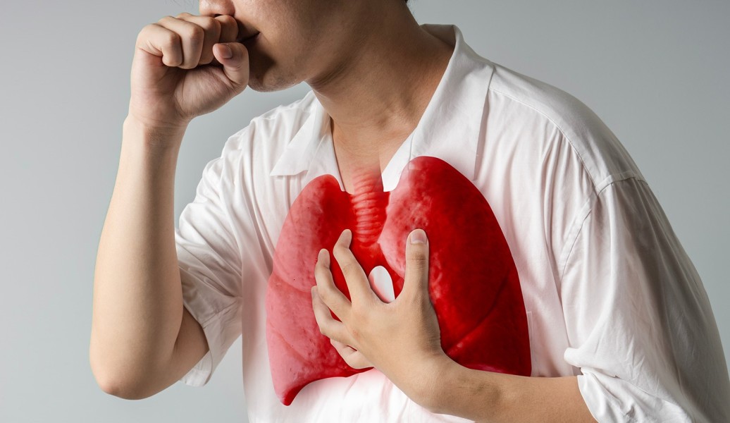 Kemenkes Dorong Deteksi Dini untuk Tekan TBC Nasional