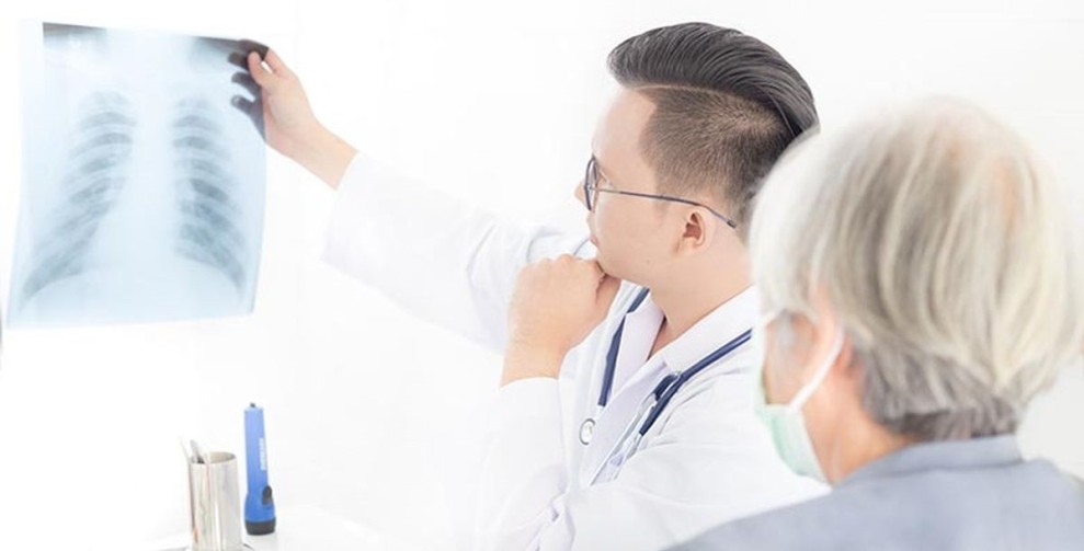 Pentingnya Diet yang Tepat untuk Pemulihan Pasien TBC, Ini Penjelasan dari Dokter Gizi