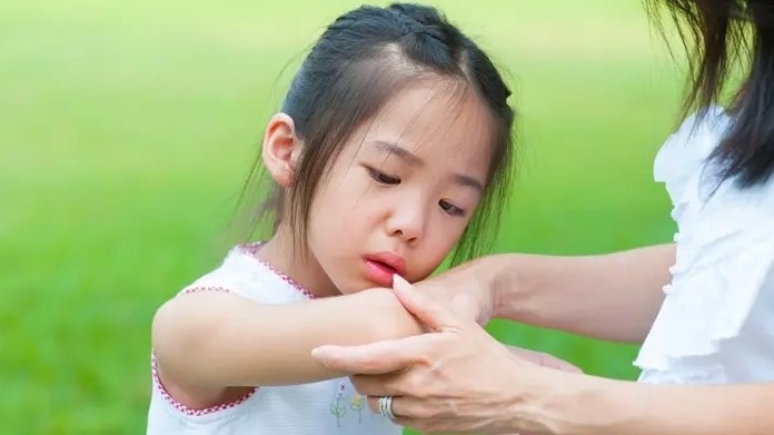 Perhatikan dengan Seksama Tanda Anak Mengalami Patah Tulang Setelah Terjatuh