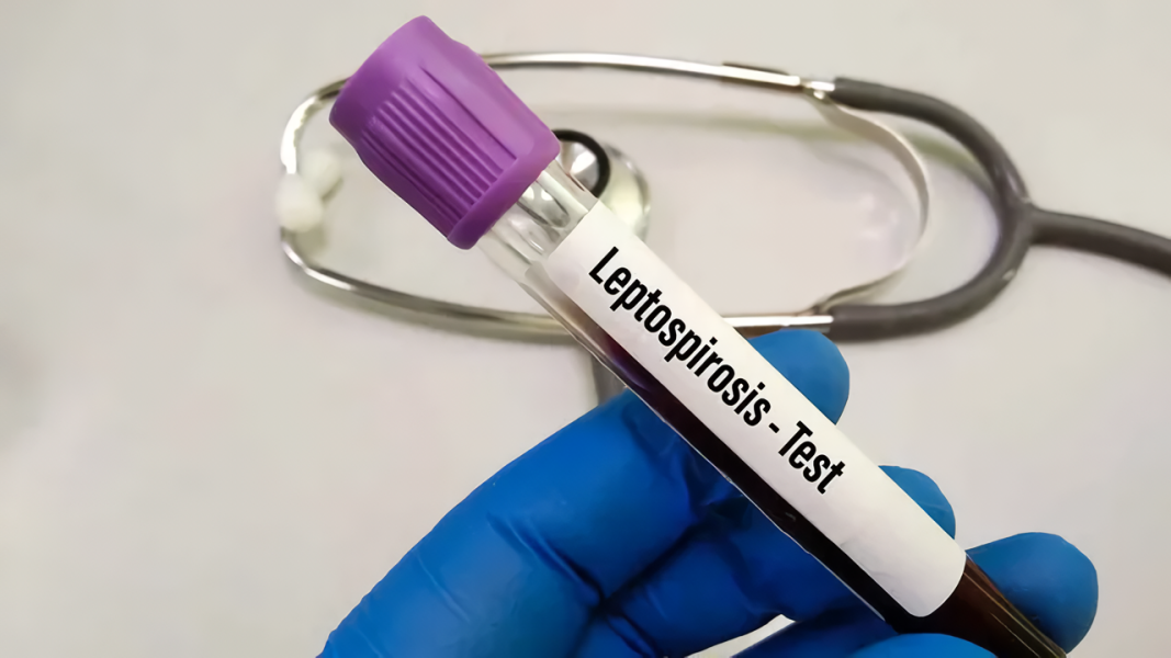 Kemenkes Ungkap Provinsi Terbanyak Kasus Leptospirosis