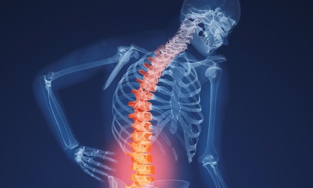 Deteksi Dini Tulang Anak: Kunci Pencegahan Osteoporosis di Masa Depan