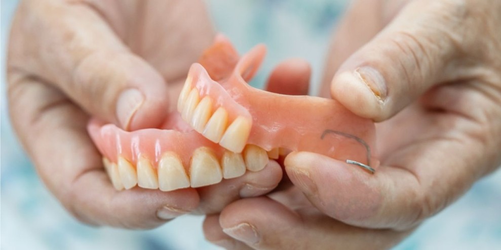 Harga Gigi Palsu Permanen: Dari Jenis, Proses, hingga Kisaran Harganya