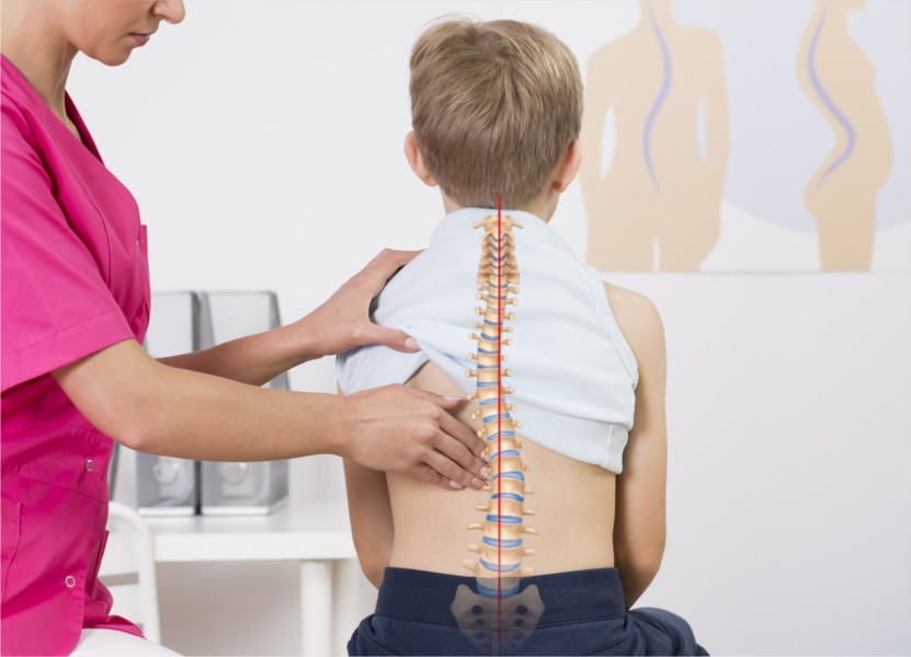 Dokter China Sukses Operasi Skoliosis, Remaja Inggris Naik 8 Cm