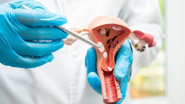 Kasus Endometriosis Remaja Meningkat, Dokter Ungkap Fakta Mengejutkan