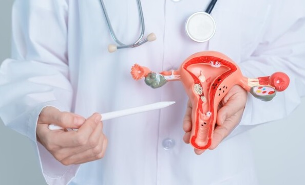 Nyeri Haid Berlebihan Bisa Menjadi Tanda Endometriosis Perlu Diwaspadai