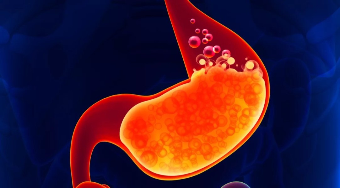 Kenali 7 Penyebab Asam Lambung Sering Kambuh dan Cara Mengatasinya