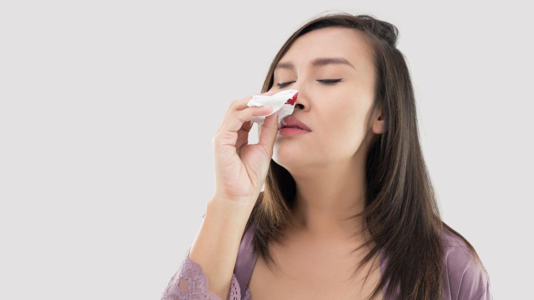 Dokter Jelaskan Pentingnya Deteksi Dini Tumor Jinak Hidung