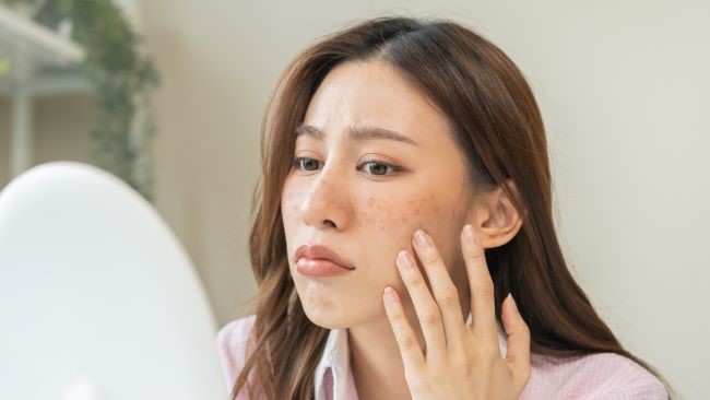 6 Bahan Alami yang Efektif Menghilangkan Flek Hitam Secara Cepat di Rumah