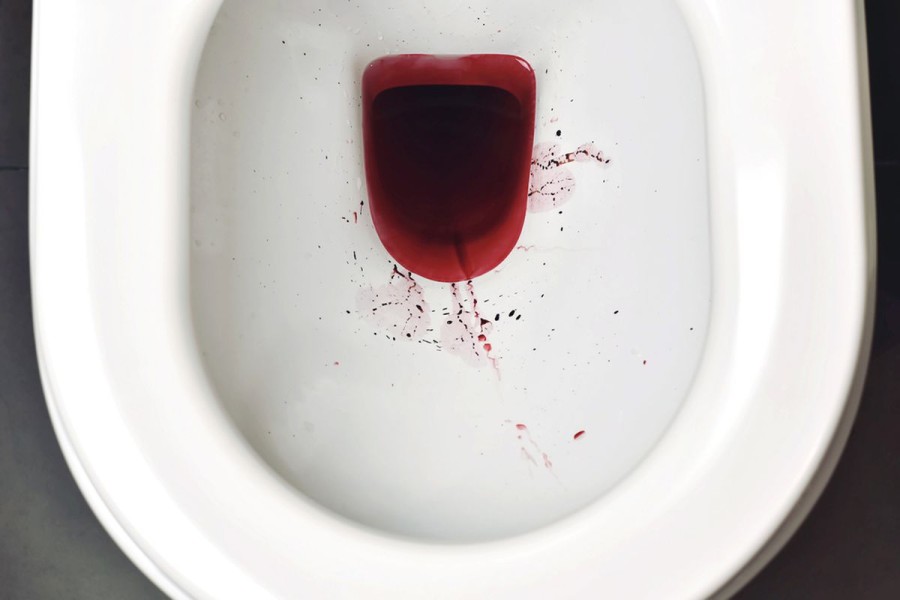 6 Gejala Kencing Merah yang Perlu Diwaspadai dan Penyebabnya
