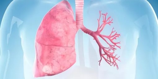 Kondisi Satu Paru Tidak Menghalangi Manusia untuk Tetap Hidup Sehat