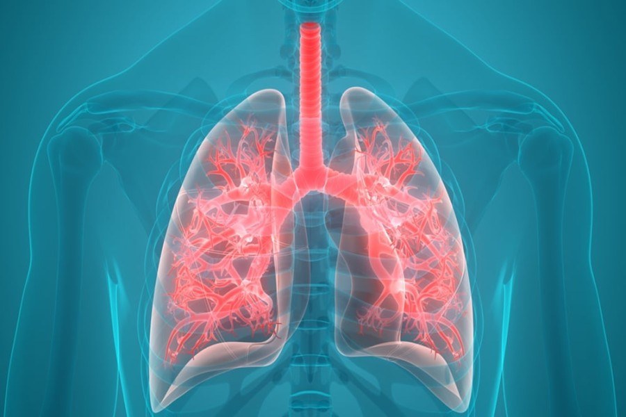 Deteksi Kanker Paru Lebih Cepat dengan Memperhatikan Perubahan Pada Kaki