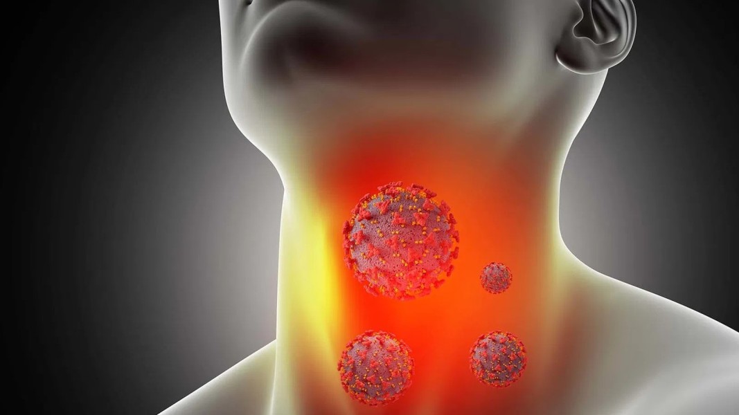 Waspada Radang Tenggorokan Anak Agar Terhindar Jantung Reumatik