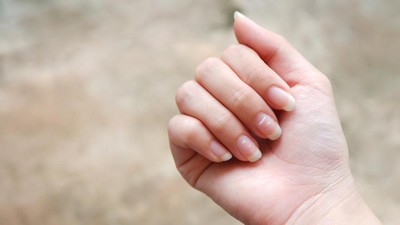 Perubahan Kuku Bisa Menjadi Indikator Dini Kanker Paru, Ini Ciri-cirinya