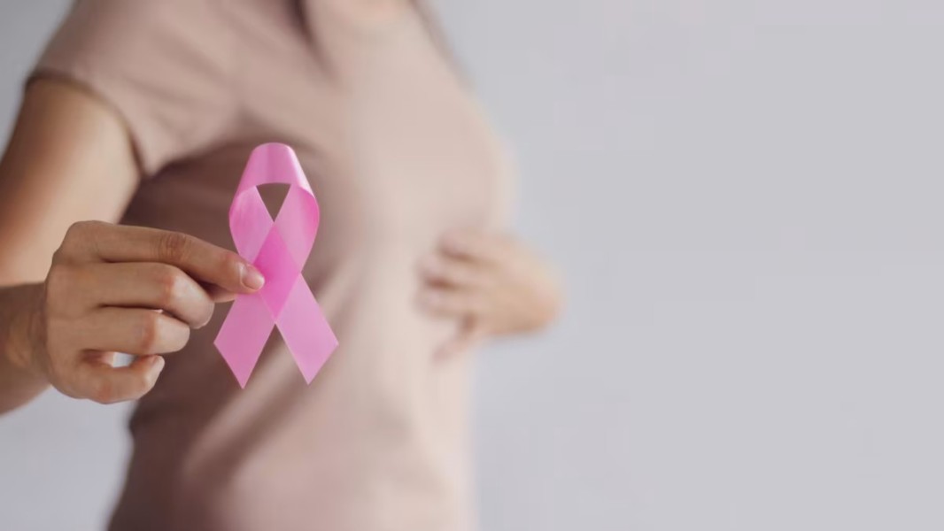 Panduan Lengkap Deteksi Dini dan Terapi Tepat Kanker Payudara di Indonesia