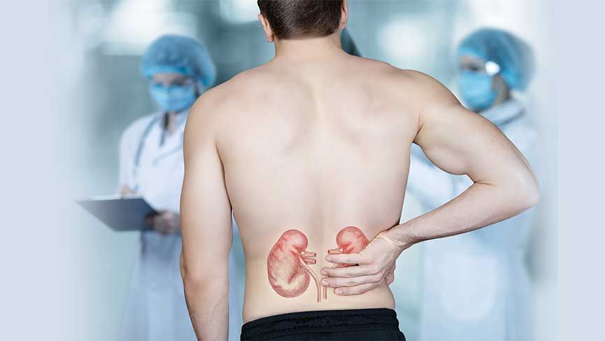 Kenali Ciri dan Letak Sakit Ginjal dari Rasa Nyerinya