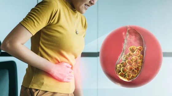 Waspadai Gangguan Pencernaan Tiba-Tiba: Kenali Risiko dan Bahaya Batu Empedu